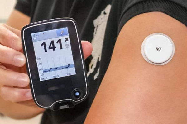 How to insert a Continuous Blood Sugar Monitor